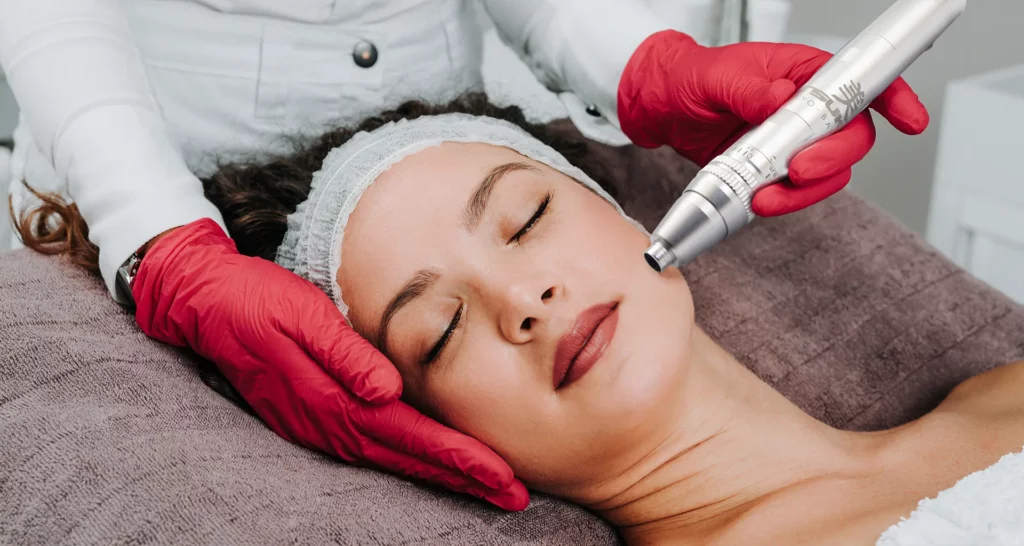 Curso Online Dermapen II